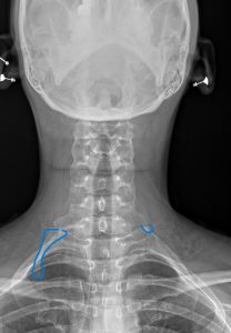 Case Study for Chiropractors and Primary Care Providers