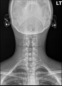 Case Study for Chiropractors and Primary Care Providers